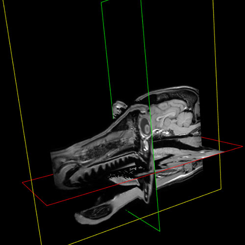 BrainViewer MRT BrainViewer